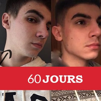 muscler sa machoire en 60jours 